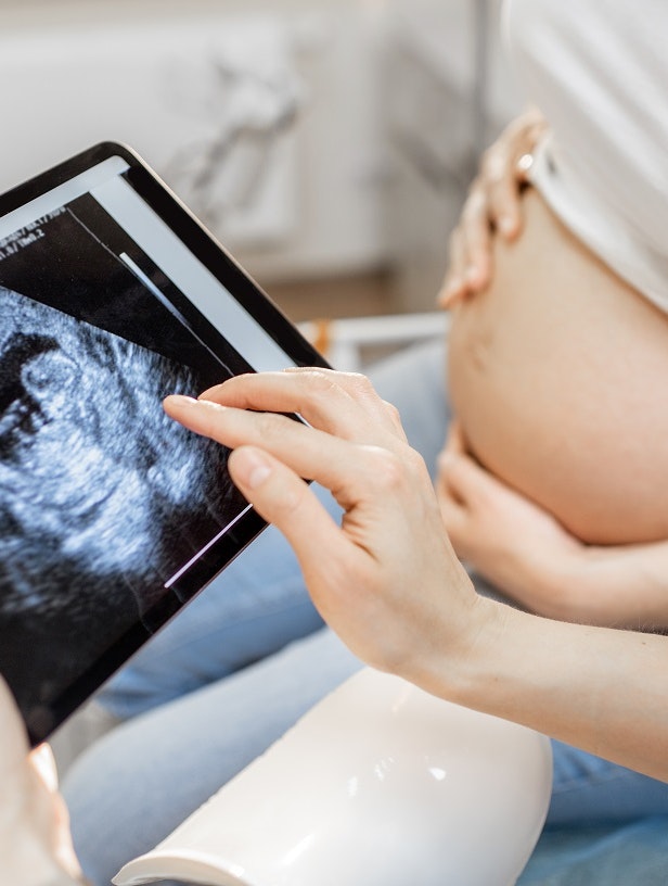 Her er, hvad du skal vide om de forskellige graviditetsscanninger