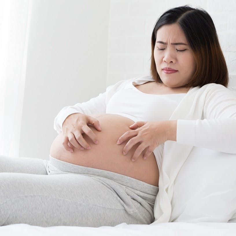 Graviditetskløe: Det skal du være opmærksom på