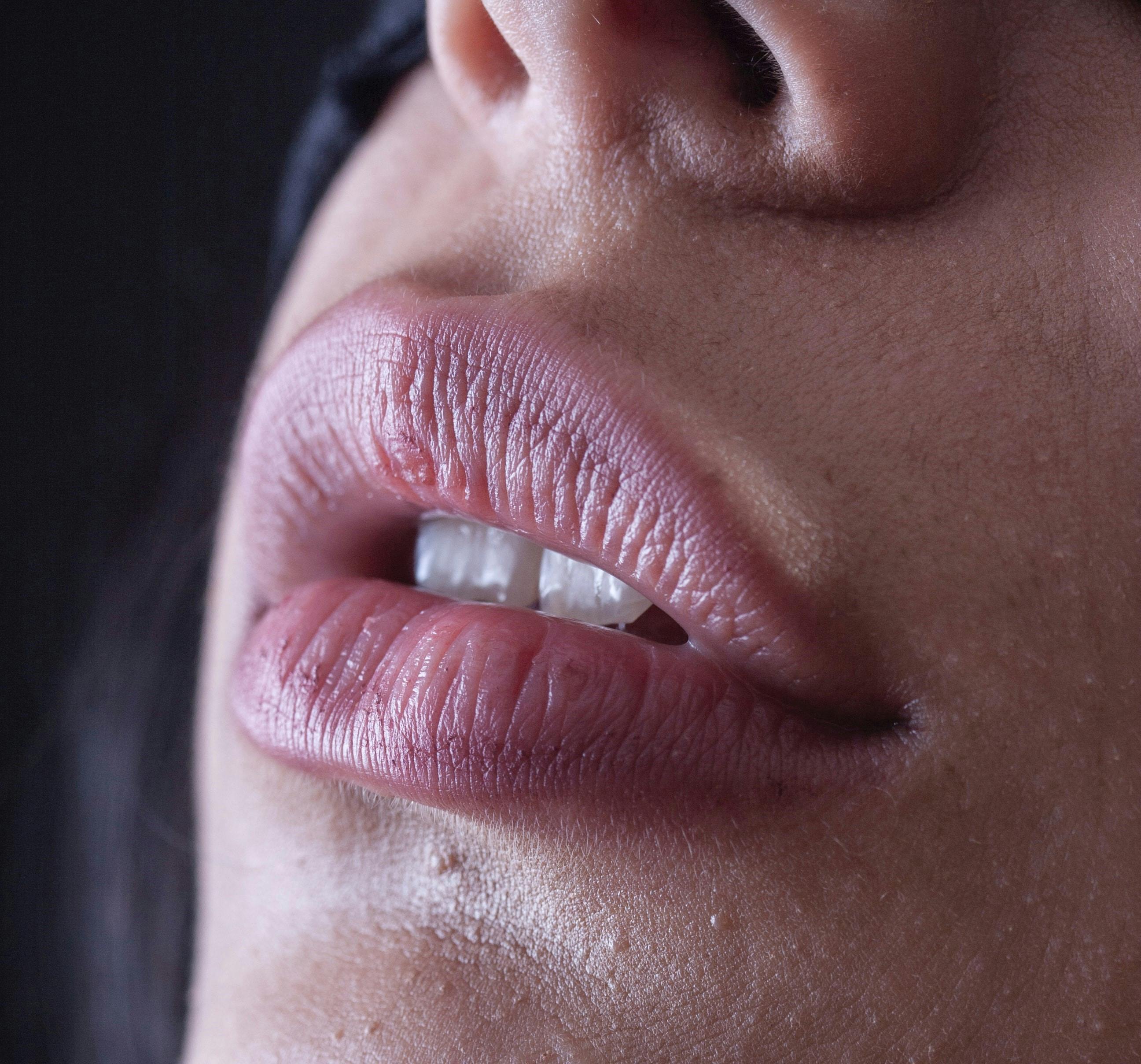 Bedste læbepomade: Vi har fundet bedste læbepomade! | femina