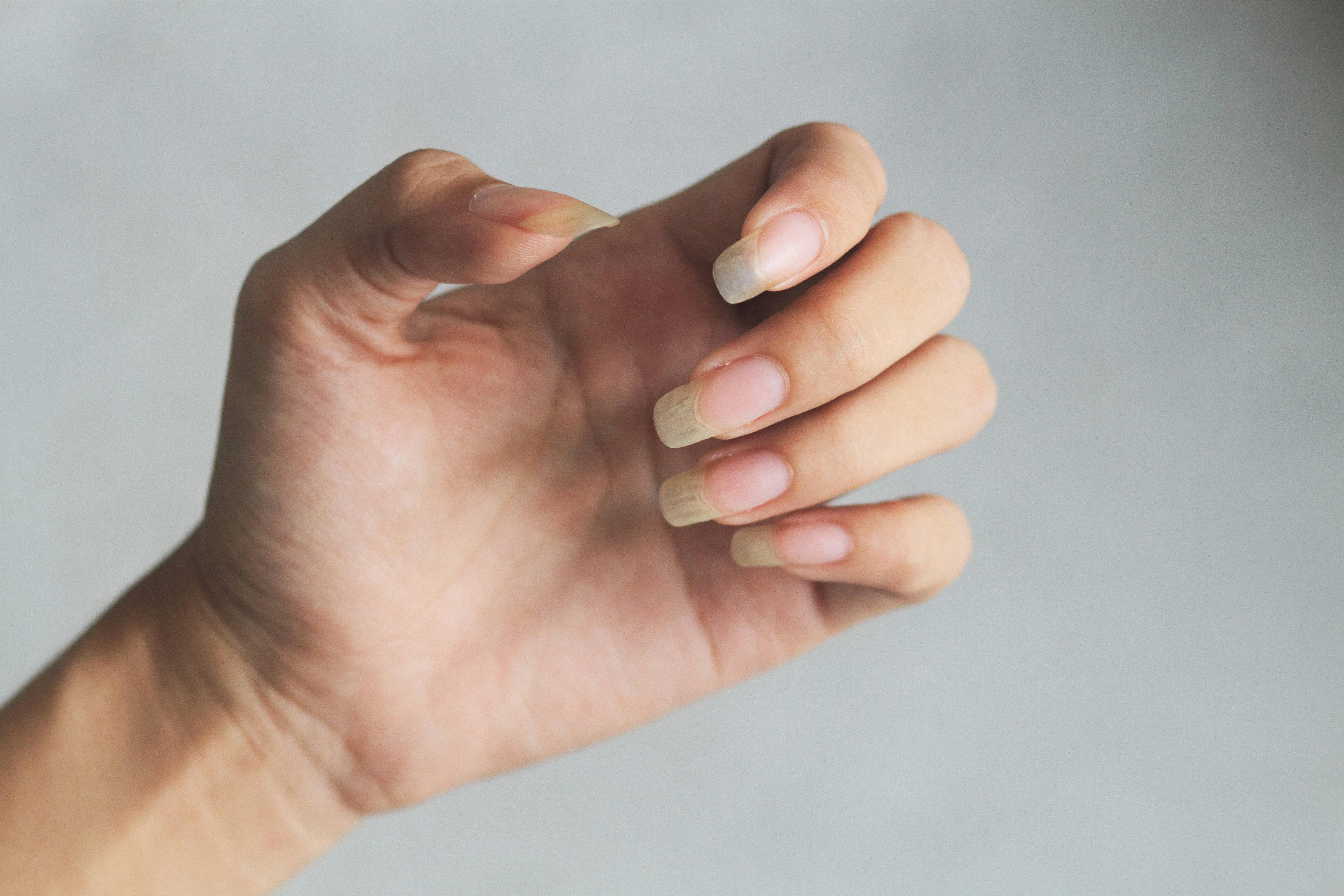 Gule – forebygger og behandler gule negle |