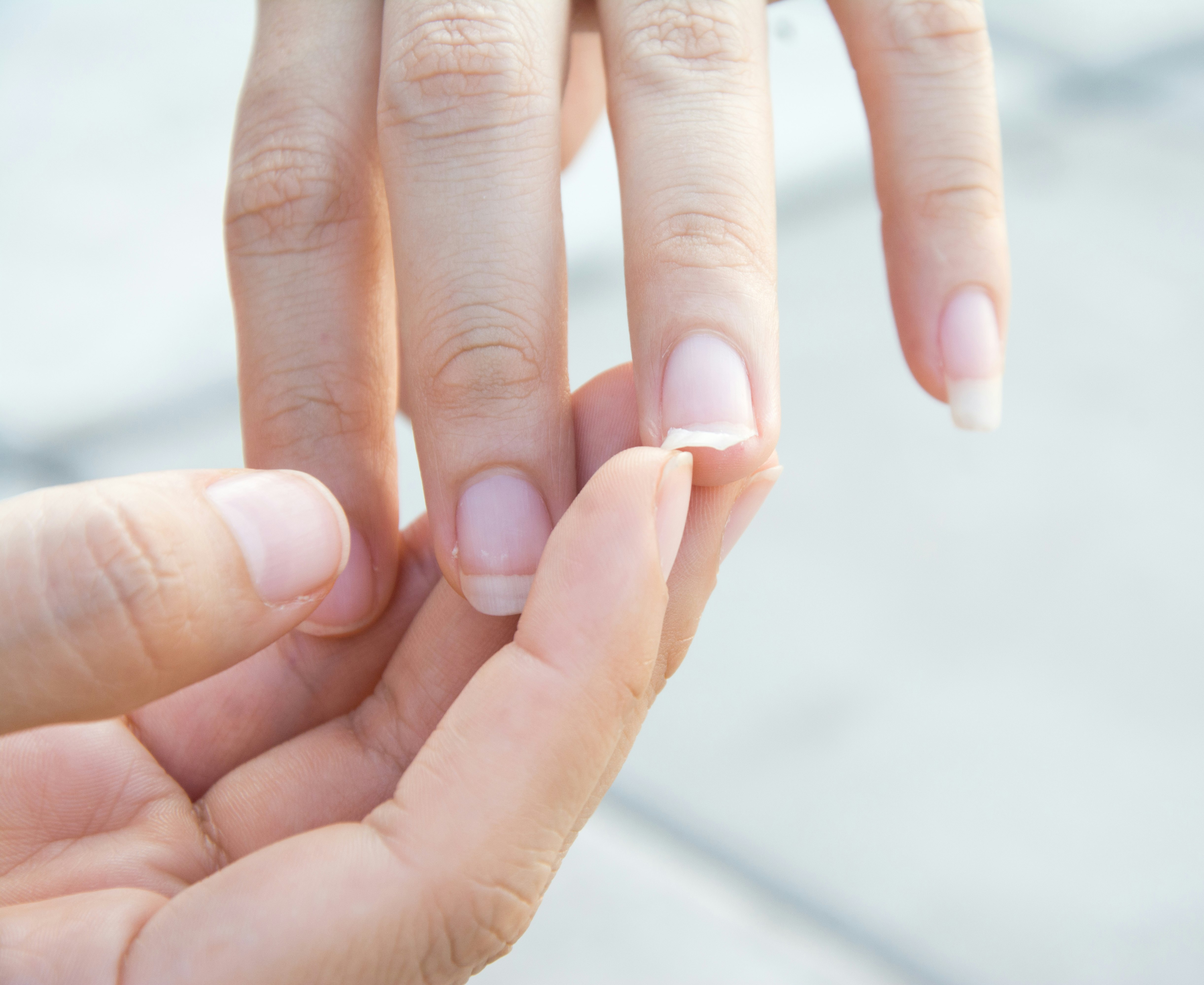 Vært for Anholdelse øje Flossede negle - 6 grunde til du har skøre negle | femina
