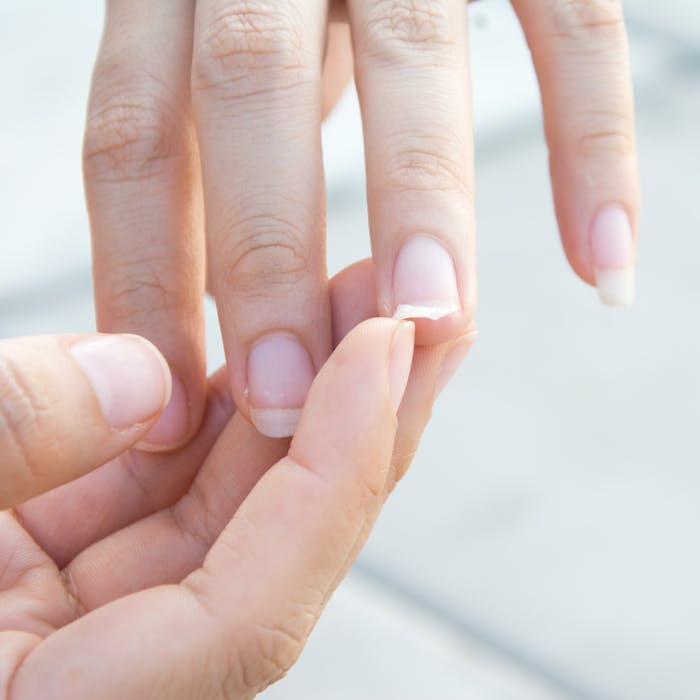Flossede negle - 6 grunde til har skøre negle femina