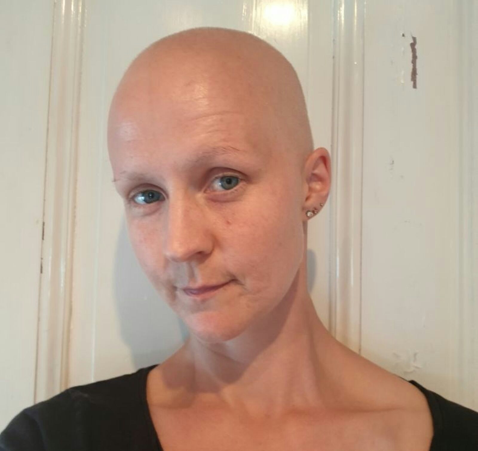 Matilda Lindmark midt i sin kræftbehandling