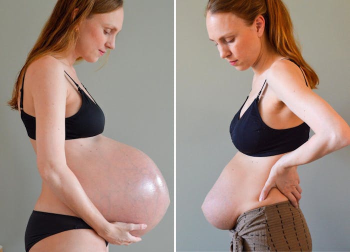 Gravide får at vide, at de efter fødslen er stille Femina