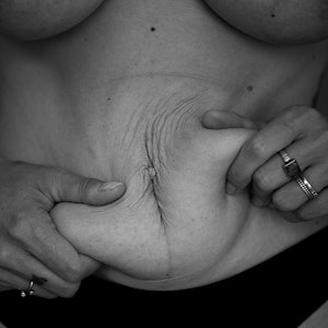 Mypostpartumself