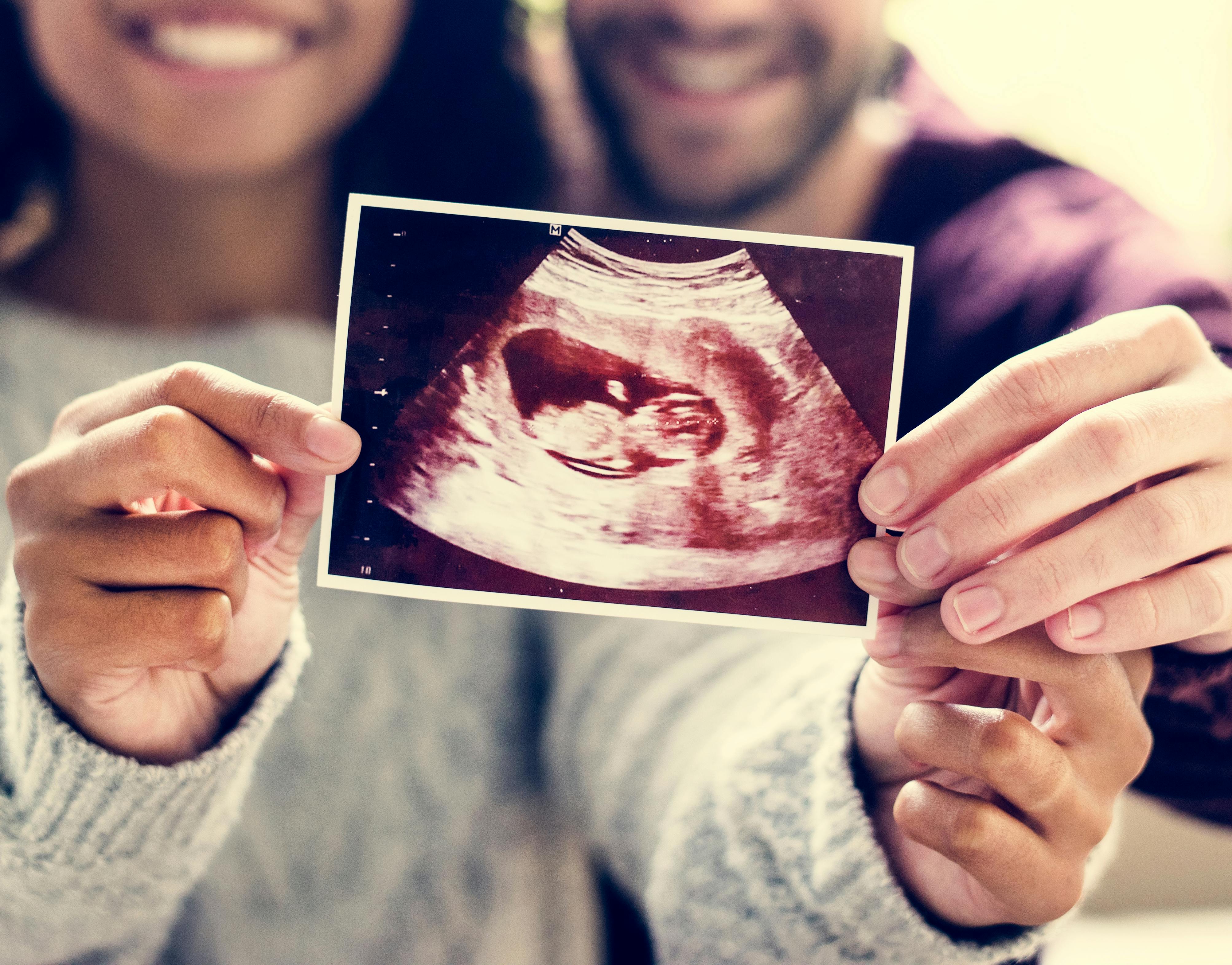 Hvornår skal man scannes som gravid?