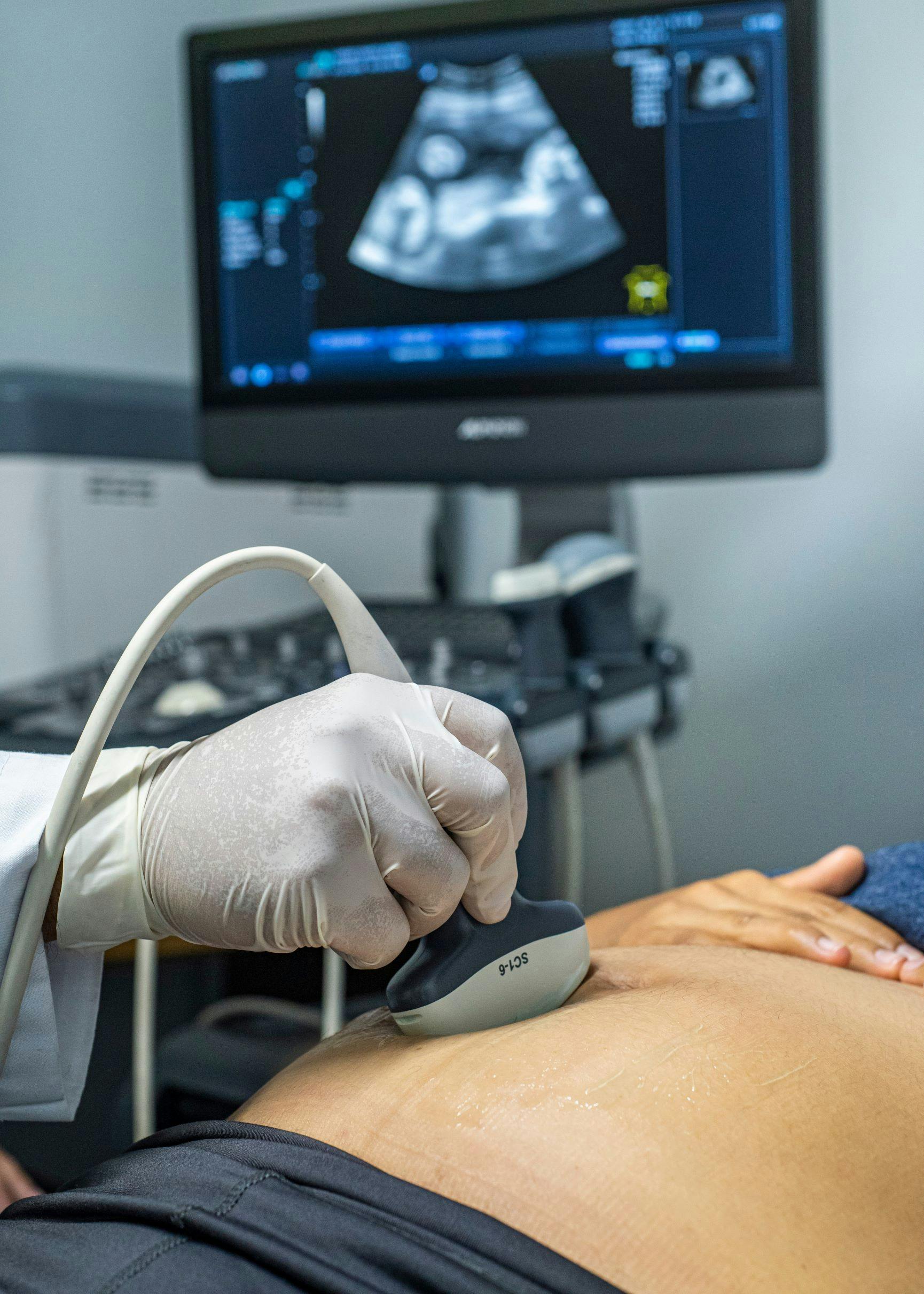 Graviditetsscanninger, nakkefoldsscanning, kønsscanning
