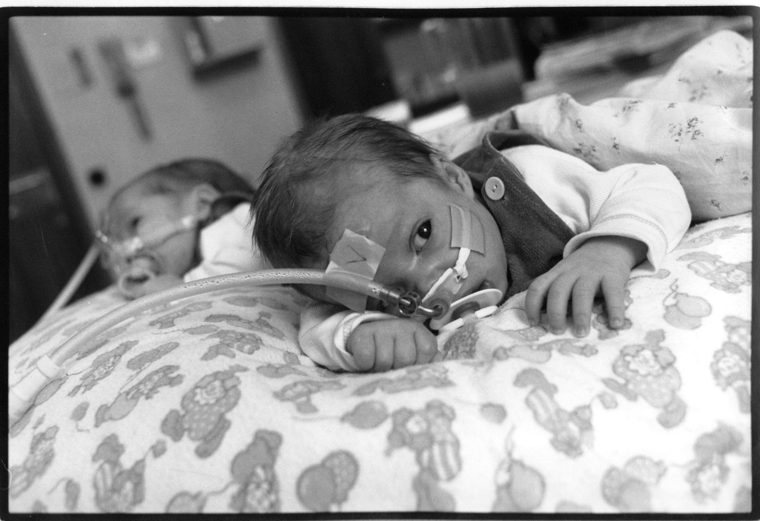 Tvillingerne i CPAP-behandling.&nbsp;
