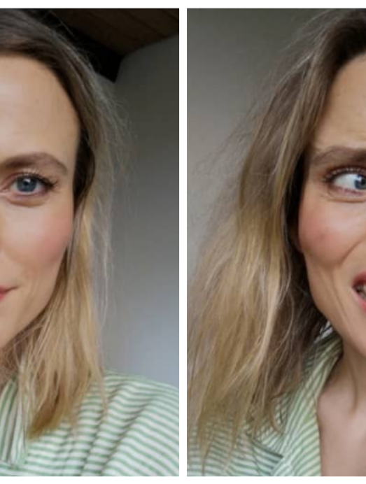 Cæcilie bruger botox: "Jeg vil vise folk, at sagtens kan se naturlig ud"
