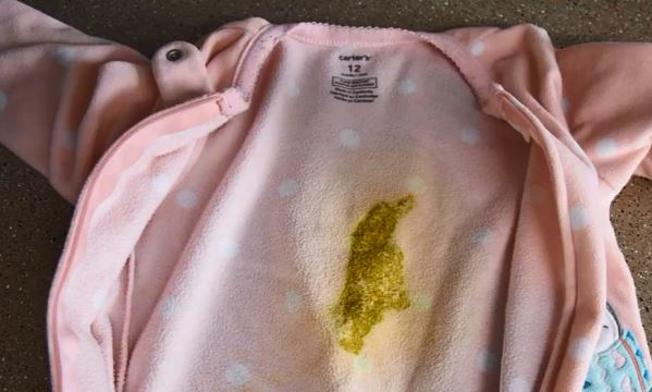 Sådan fjerner du babys gule afføring fra tøjet |