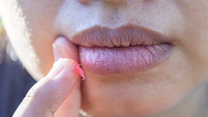 samvittighed Bevægelse malt Tørre læber - Slip for tørre læber med 4 simple tricks | femina