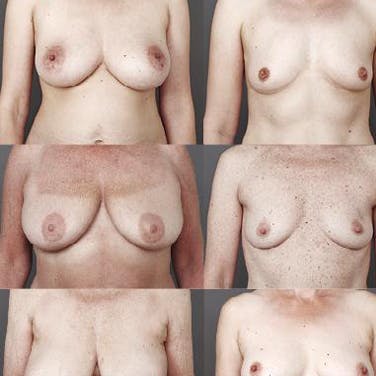 https://dk-femina-backend.imgix.net/media/websites/femina-dot-dk/website/dig-og-dit-liv/taet-paa-dig/2012/09/1239-brystkampagne/1239-brystkampagne-art.jpg