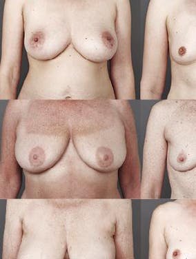 https://dk-femina-backend.imgix.net/media/websites/femina-dot-dk/website/dig-og-dit-liv/taet-paa-dig/2012/09/1239-brystkampagne/1239-brystkampagne-art.jpg