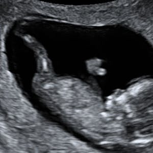 https://dk-femina-backend.imgix.net/media/websites/mama/gravid/gravid-uge-for-uge/billeder-beskret/12prim.jpg