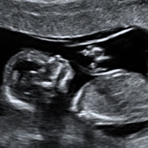 https://dk-femina-backend.imgix.net/media/websites/mama/gravid/gravid-uge-for-uge/billeder-beskret/14prim.jpg?ixlib=vue-2.9.1&auto=format&width=300&height=300&fit=crop&fp-x=0.5&fp-y=0.5