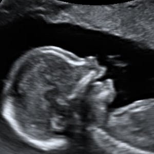 https://dk-femina-backend.imgix.net/media/websites/mama/gravid/gravid-uge-for-uge/billeder-beskret/17prim.jpg