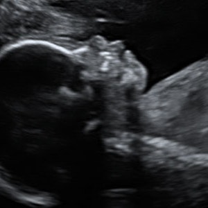 https://dk-femina-backend.imgix.net/media/websites/mama/gravid/gravid-uge-for-uge/billeder-beskret/23prim.jpg?ixlib=vue-2.9.1&auto=format&width=300&height=300&fit=crop&fp-x=0.5&fp-y=0.5