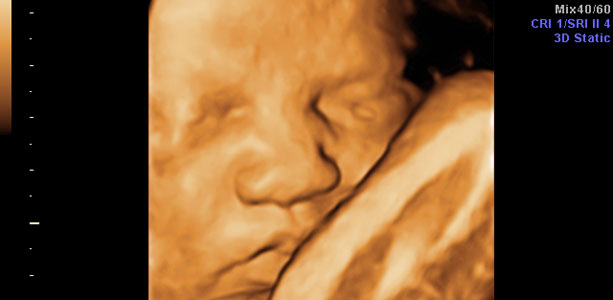 Gravid uge 36: at være mama.dk