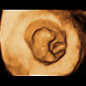 https://dk-femina-backend.imgix.net/media/websites/mama/gravid/gravid-uge-for-uge/billeder-beskret/8prim.jpg?ixlib=vue-2.9.1&auto=format&width=300&height=300&fit=crop&fp-x=0.5&fp-y=0.5